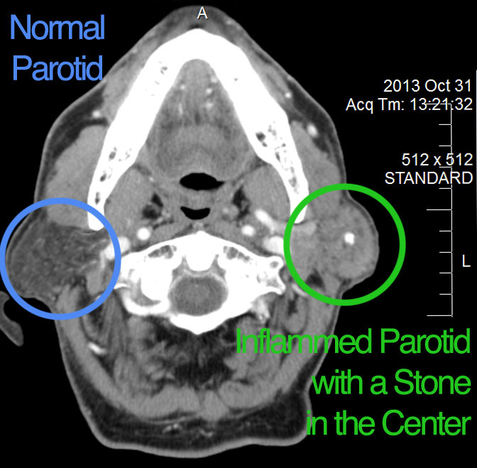 CT Scan image