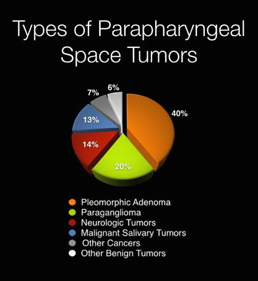 Pie chart of how common different tumors are