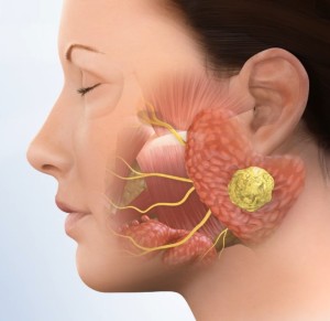 Thoughts about the basic principles of parotid surgery