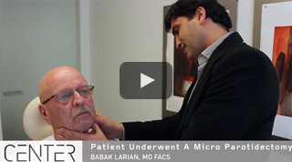 Micro Parotidectomy Surgery video